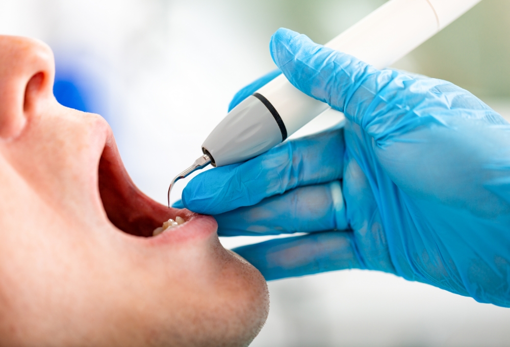 予防・クリーニング